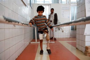 Children in Yemen face life-threatening malnutrition and are being drafted as soldiers in year-old war